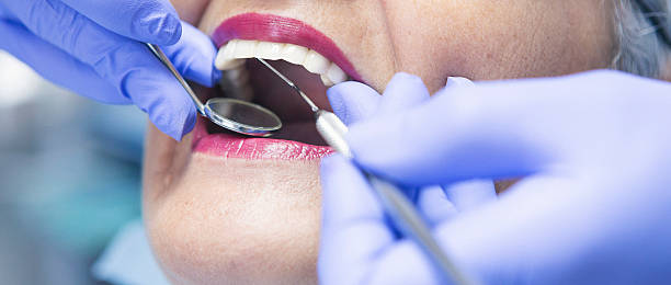 Best Emergency Root Canal Treatment in Healdsburg, CA
